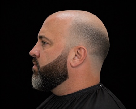 Skin Fade Around Bald Crown with Tapered Beard — barber reference photo