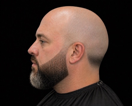Bald Top with Faded Nape and Chin-Heavy Beard — barber reference photo